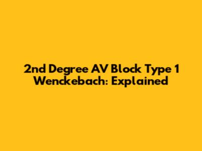 2nd Degree AV Block Type 1 Wenckebach: Explained