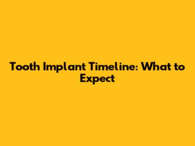 Tooth Implant Timeline: What to Expect